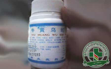 治疗银屑病(牛皮癣)能用牛黄乌蛇片吗?