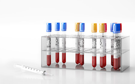 银屑病预防,怎样预防银屑病好