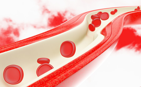 春季怎样预防牛皮癣,春天怎样预防牛皮癣