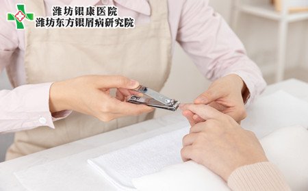 手部牛皮癣护理,手上有牛皮癣怎样护理