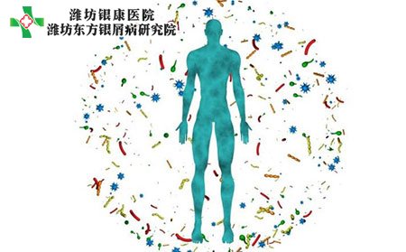 潍坊银屑病医院介绍青壮年男性如何预防银屑病